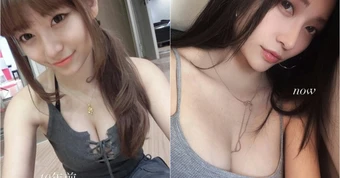 Bị đồn đoán thẩm mỹ Q1,hot girl xinh đẹp bức xúc, tung bằng chứng thanh minh