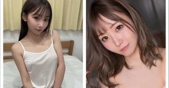 Tự ti suốt 25 năm vì căn bệnh "khó nói", hot girl xinh đẹp chia sẻ quá khứ xấu hổ với crush, fan cảm thông tột độ