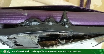 Thêm một smartphone Samsung bị nghi phát nổ khi sạc, người dùng bị bỏng nhẹ