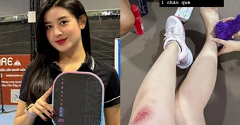 Á hậu Huyền My gặp tai nạn khi chơi pickleball