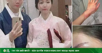 Anh trai Jisoo bị vợ cũ tố đánh đập, bạo hành tình dục dã man