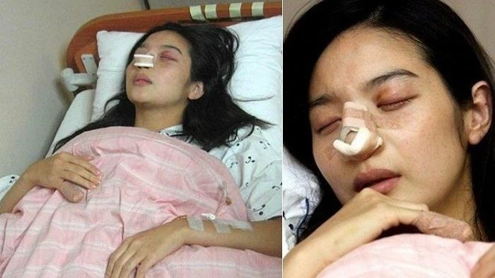 Bi kịch nữ diễn viên ly hôn sau 12 ngày cưới vì bị chồng đánh sảy thai, nhìn thương tích mà nhói lòng