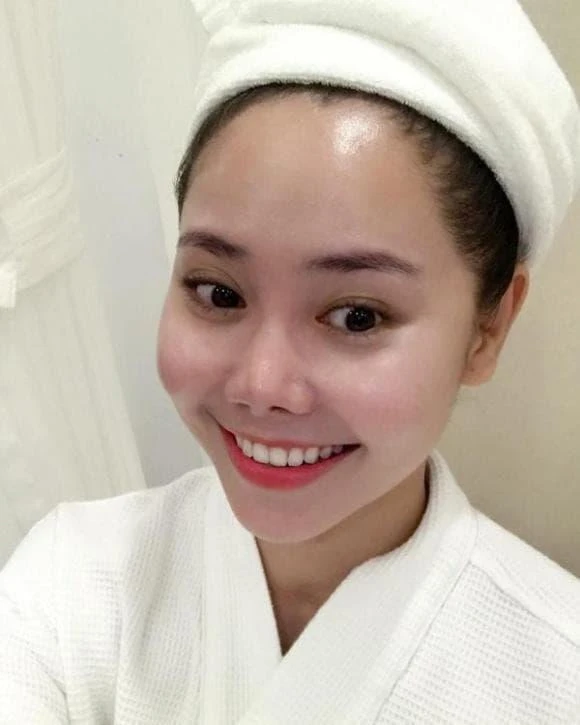 Bức ảnh chụp cận sau ca can thiệp "dao kéo" khiến mỹ nhân Việt lao đao, phải trả giá đắt