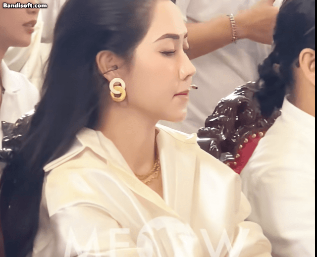 Bức ảnh chụp cận sau ca can thiệp "dao kéo" khiến mỹ nhân Việt lao đao, phải trả giá đắt