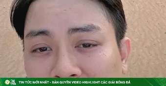 Ca sĩ Hoài Lâm lại đổi tên