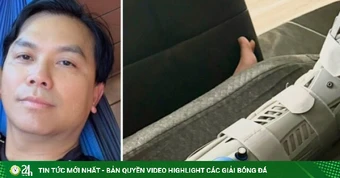 Ca sĩ Mạnh Quỳnh bị vỡ xương mắt cá chân