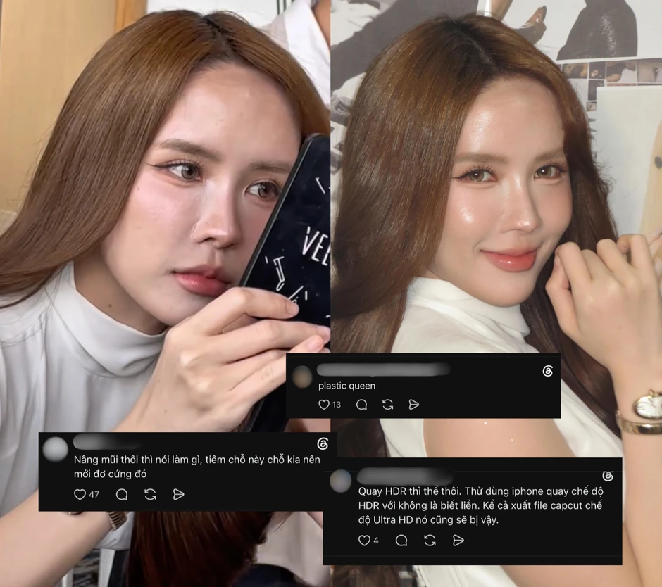 Gương mặt của Thiều Bảo Trâm đang khiến nhiều người lo lắng Gương mặt của Thiều Bảo Trâm đang khiến nhiều người lo lắng