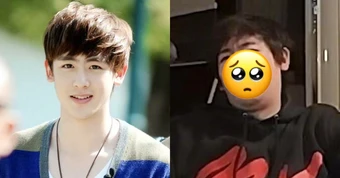 Gương mặt xuống cấp phù nề không tin nổi của hoàng tử lai đẹp nhất showbiz, xem xong còn tưởng bị ảo giác