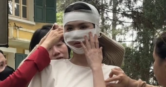 Hình ảnh Ngọc Trinh băng bó kín cả mặt