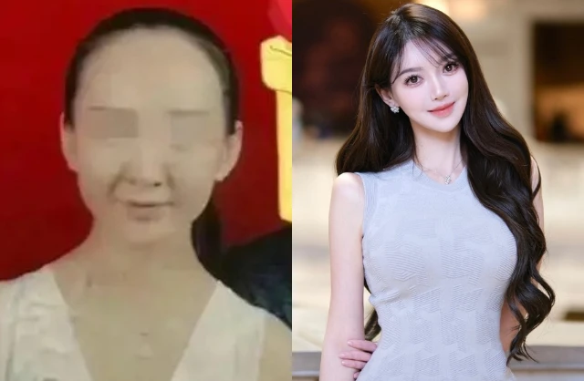 Hoa khôi sinh con cho Huỳnh Hiểu Minh “dao kéo” 100% cơ thể, xem diện mạo trước chỉnh sửa mà sốc nặng