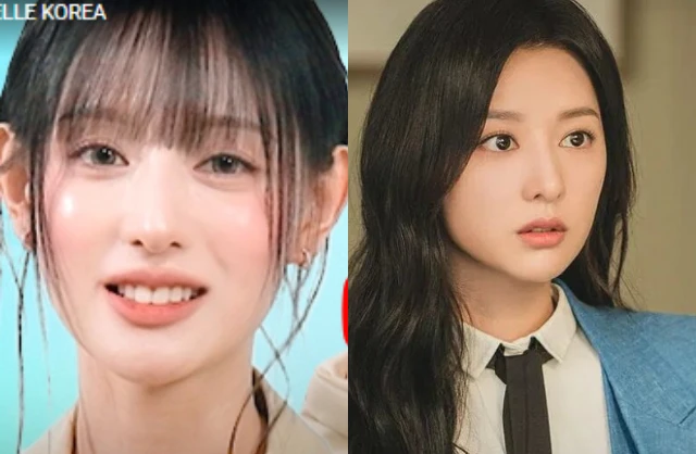 Không thể nhận ra Kim Ji Won nữa, gương mặt biến dạng hiện tại gây hoang mang tột độ