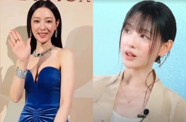 Không thể nhận ra Kim Ji Won nữa, gương mặt biến dạng hiện tại gây hoang mang tột độ