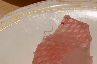 Kinh hoàng cảnh sinh vật lạ "ngọ nguậy" bò ra từ miếng cá sống tại nhà hàng sushi nổi tiếng