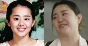 Moon Geun Young bị hoại tử và phát tướng mất kiểm soát do bệnh quái ác, bỏ lỡ giai đoạn vàng để điều trị