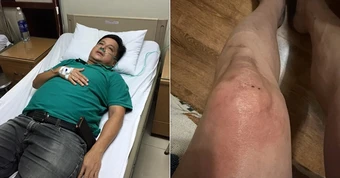 NSƯT Chí Trung mắc bệnh lạ