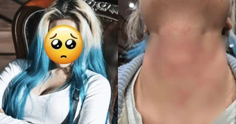 Nữ ca sĩ bị hành hung nghiêm trọng, còn bị ép viết thư xin lỗi
