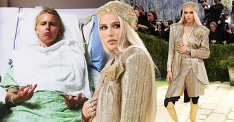 Nữ người mẫu bị cắt cụt chân, 14 năm sau mang chân giả đến đại náo Met Gala