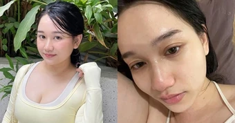Tình hình hiện tại của Trúc Anh