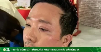 Trấn Thành chỉ ngủ 12 phút/ngày