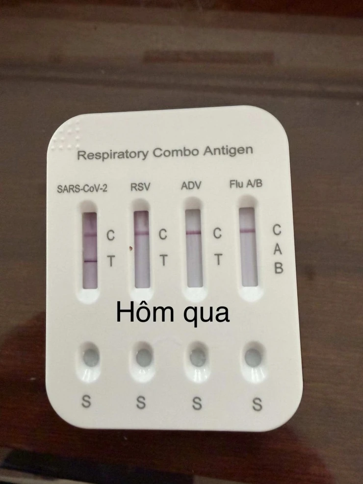Tuấn Hưng mắc Covid-19, Dương Edward nhập viện cấp cứu