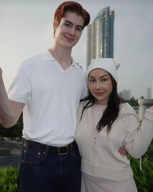 Gương mặt sau 21 ngày phẫu thuật thẩm mỹ của cô vợ cao 1m55 áp lực vì chồng Tây quá đẹp trai, cao gần 2m