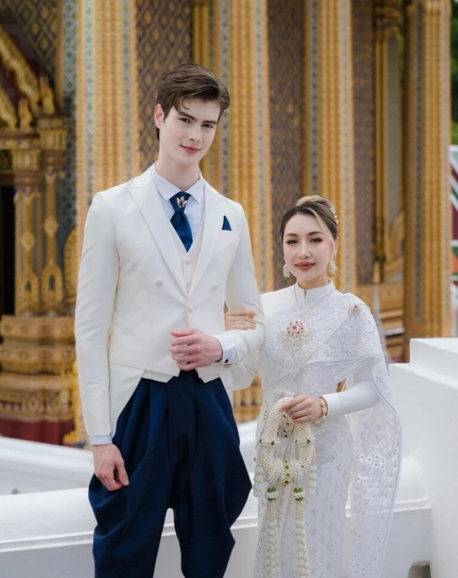 Gương mặt sau 21 ngày phẫu thuật thẩm mỹ của cô vợ cao 1m55 áp lực vì chồng Tây quá đẹp trai, cao gần 2m