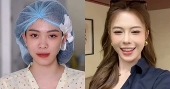 Hà Môi “đắp tiền lên mặt” để sửa những gì? Còn chiếc mũi “đang hếch dần và méo” giờ ra sao?