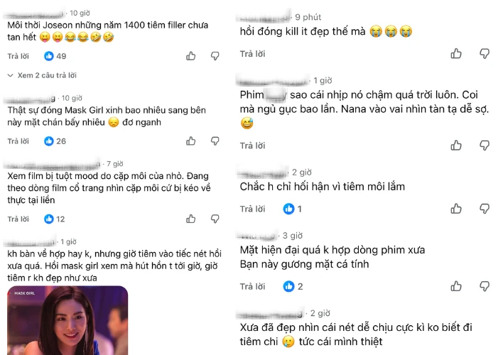 Mỹ nhân đẹp nhất thế giới vướng tranh cãi vì tiêm filler lố