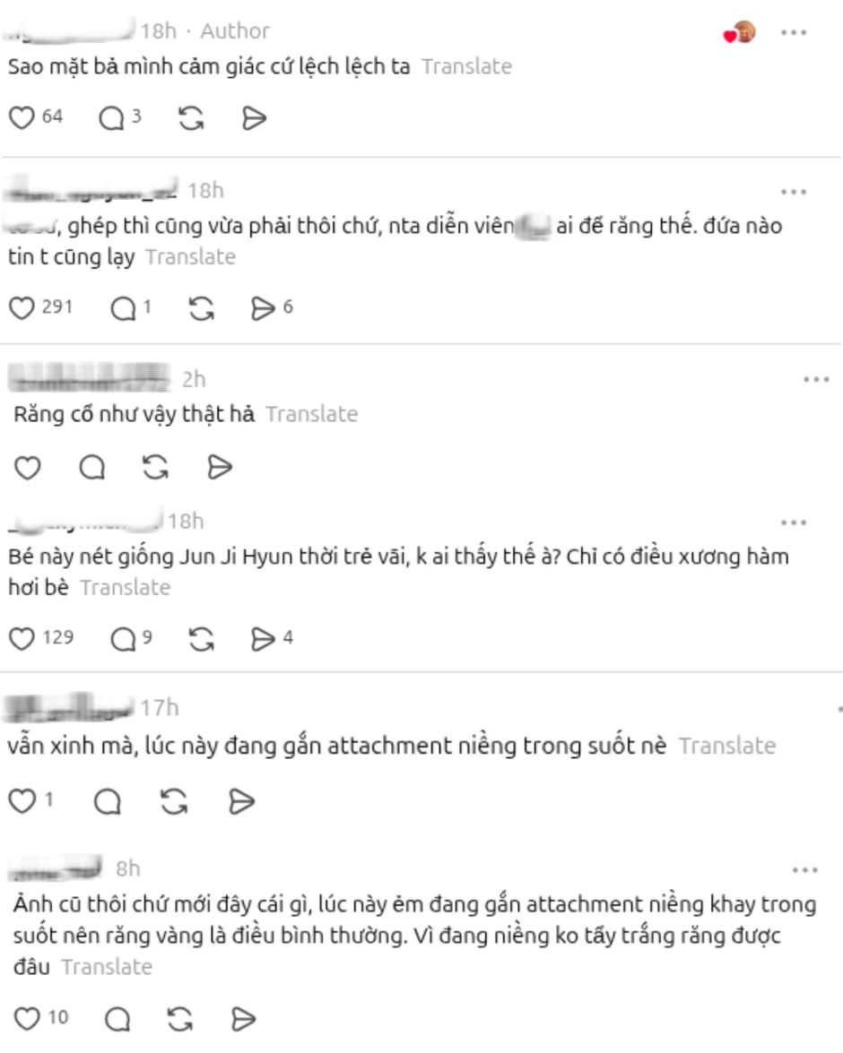 Nữ chính hot nhất Trung Quốc bị soi ảnh chưa chỉnh sửa, lộ răng vàng?