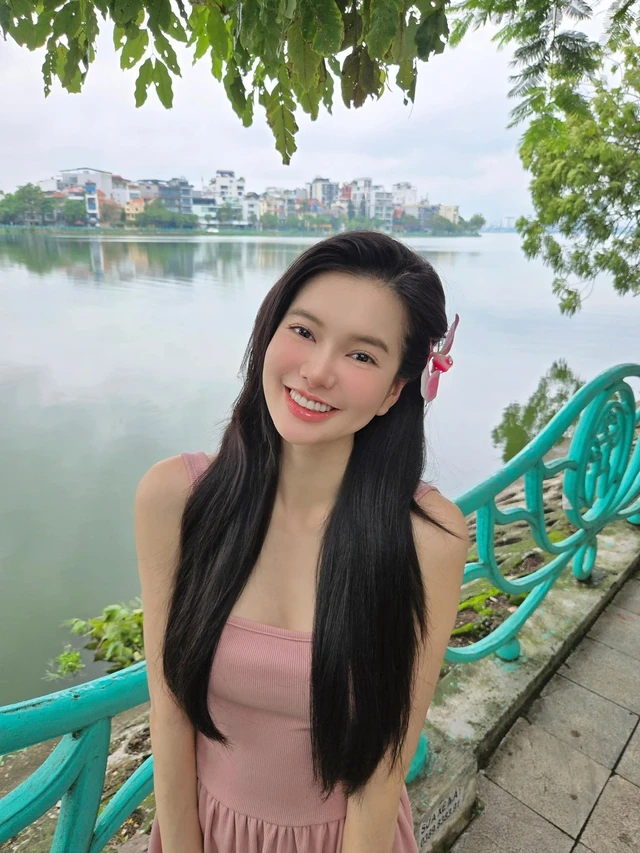 Yên Đan lột xác nhờ phẫu thuật hàm móm