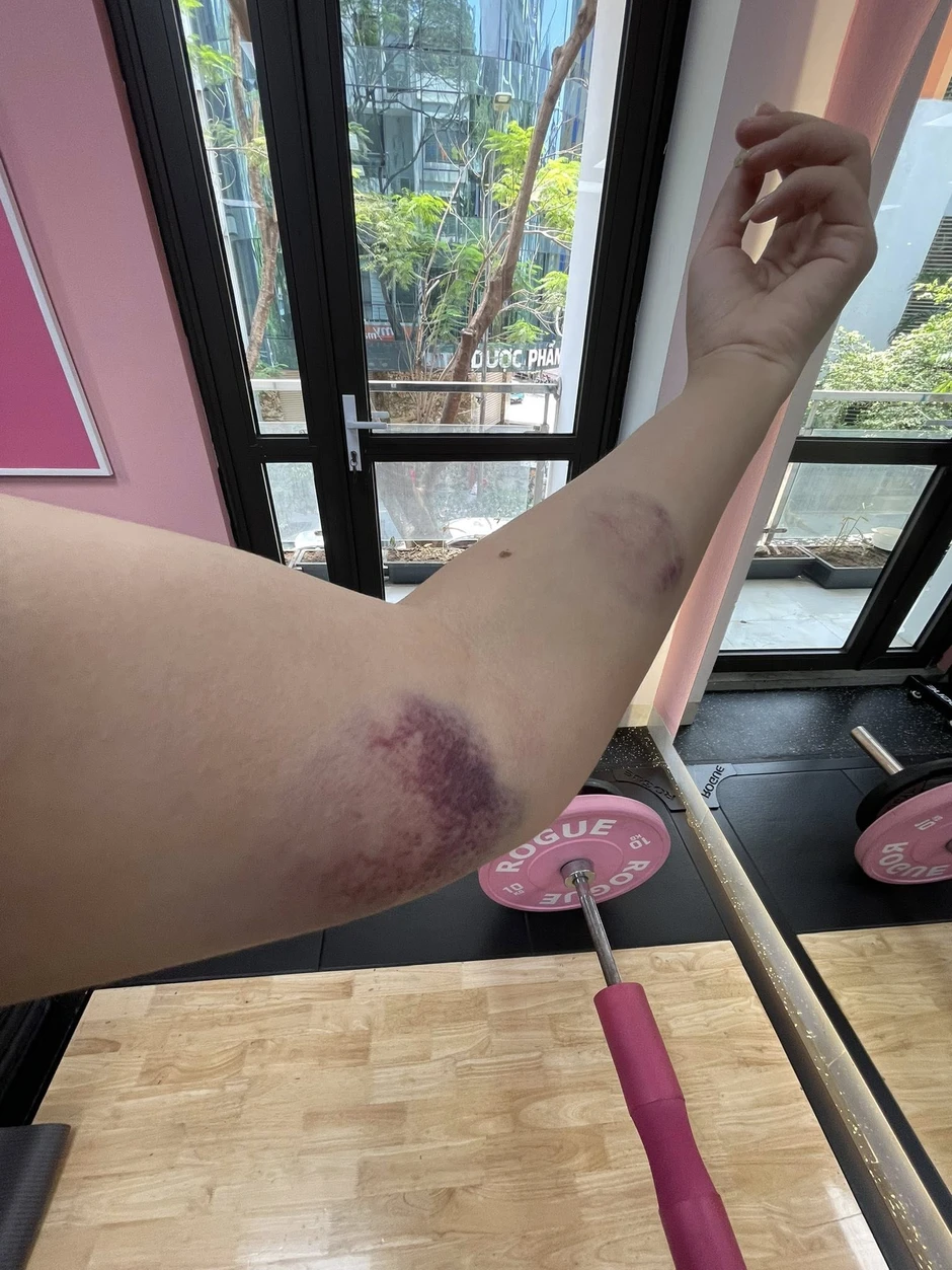 Nỗi niềm khó nói của hội chị em khi chơi bắn cung, nhìn "hậu quả" khiến ai cũng phải xót xa