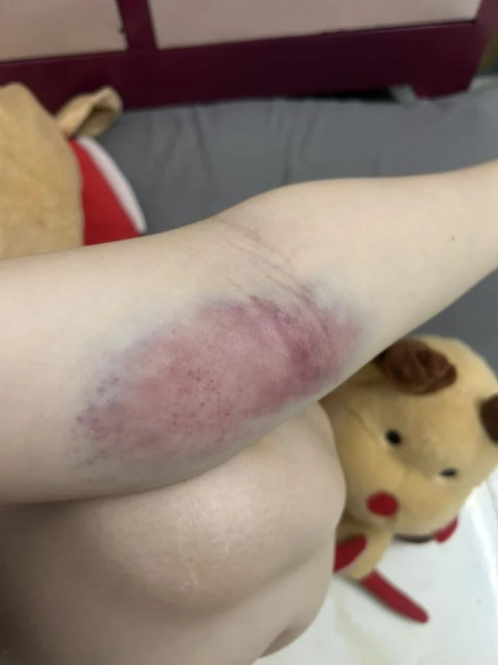 Nỗi niềm khó nói của hội chị em khi chơi bắn cung, nhìn "hậu quả" khiến ai cũng phải xót xa