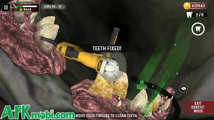 Shark Teeth Dentist Simulator - Làm nha sĩ chữa răng cho cá mập